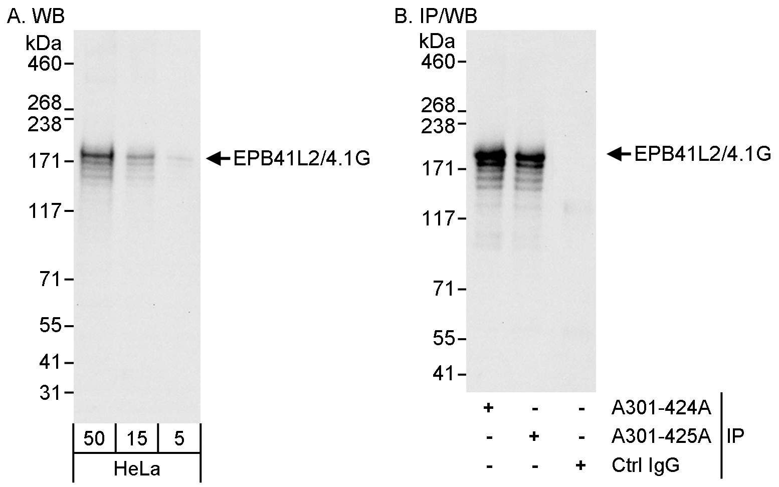 Detection of human EPB41L2/4.1G by western blot and immunoprecipitation.