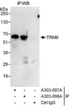 Detection of human TRM6 by western blot of immunoprecipitates.
