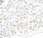 Detection of mouse RALY by immunohistochemistry.