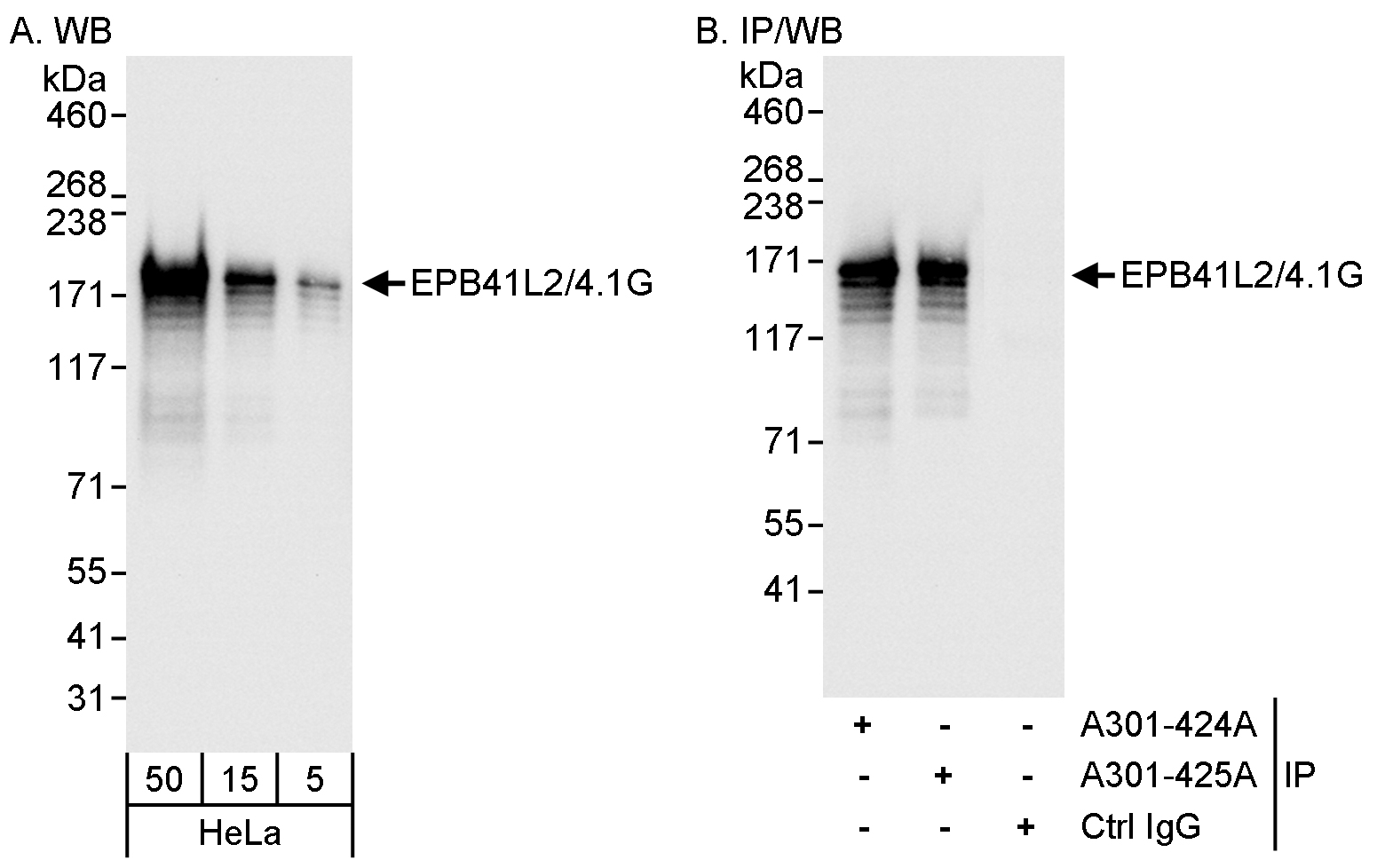 Detection of human EPB41L2/4.1G by western blot and immunoprecipitation.