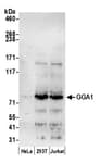 Detection of human GGA1 by western blot.