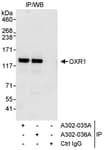 Detection of human OXR1 by western blot of immunoprecipitates.