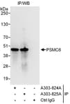 Detection of human PSMC6 by western blot of immunoprecipitates.