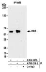 Detection of human CD5 by western blot of immunoprecipitates.