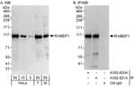 Detection of human and mouse RABEP1 by western blot (h&amp;m) and immunoprecipitation (h).