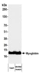 Detection of human Myoglobin by western blot.