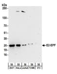 Detection of human and mouse E2-EPF by western blot.