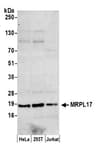 Detection of human MRPL17 by western blot.