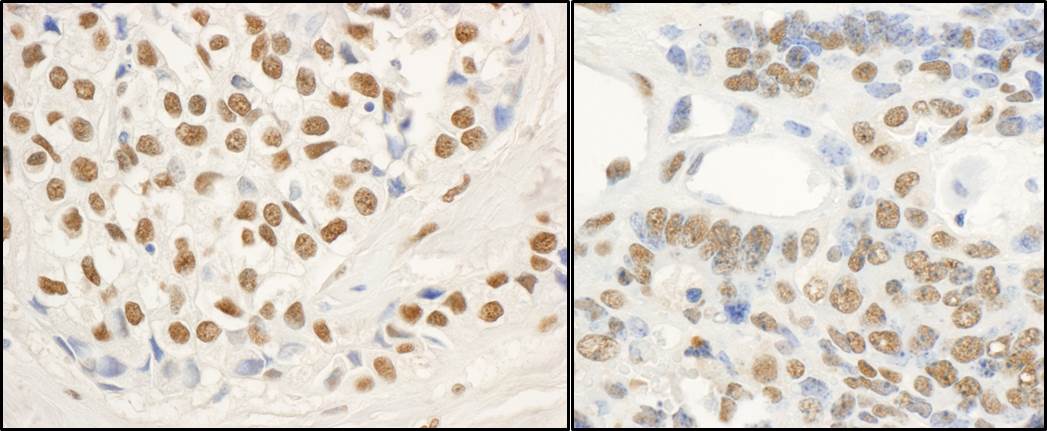 Detection of human and mouse FUS by immunohistochemistry.