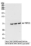 Detection of human TRPC3 by western blot.