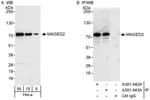 Detection of human MAGED2 by western blot and immunoprecipitation.