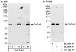 Detection of human and mouse CoCoA by western blot (h&amp;m) and immunoprecipitation (h).
