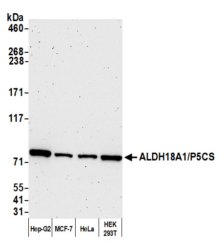 Detection of human ALDH18A1/P5CS by western blot.