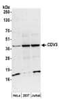 Detection of human CDV3 by western blot.