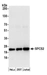 Detection of human SPCS2 by western blot.