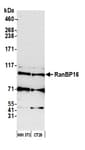 Detection of human RanBP16 by western blot.
