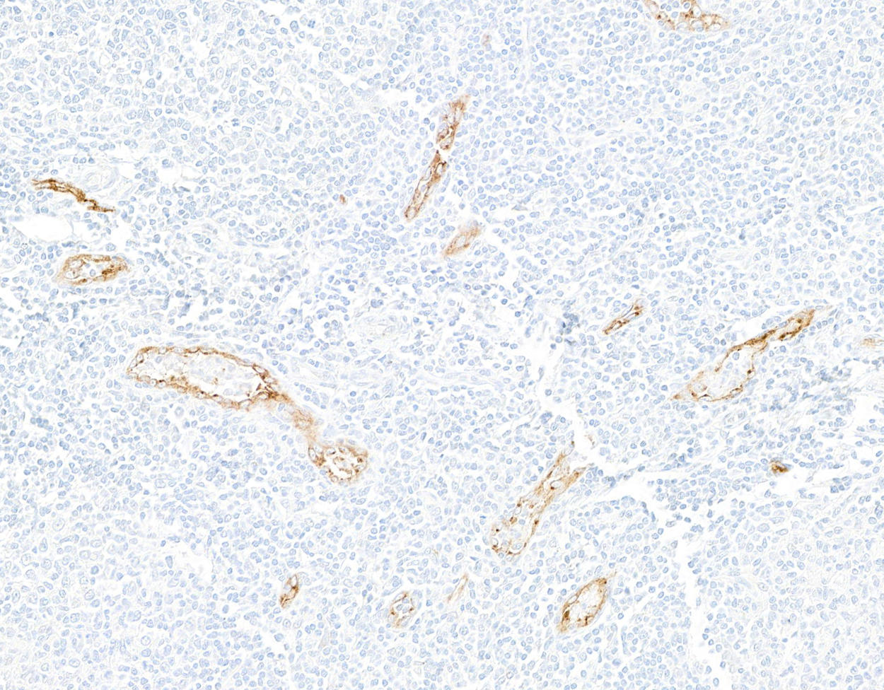 Detection of human P-Selectin/CD62P by immunohistochemistry.