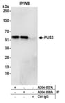 Detection of human PUS3 by western blot of immunoprecipitates.