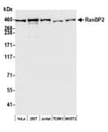 Detection of human and mouse RanBP2 by western blot.