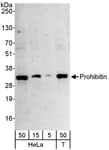 Detection of human Prohibitin by western blot.