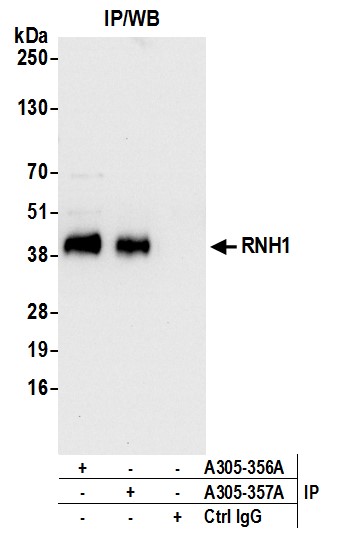 Detection of human RNH1 by western blot of immunoprecipitates.