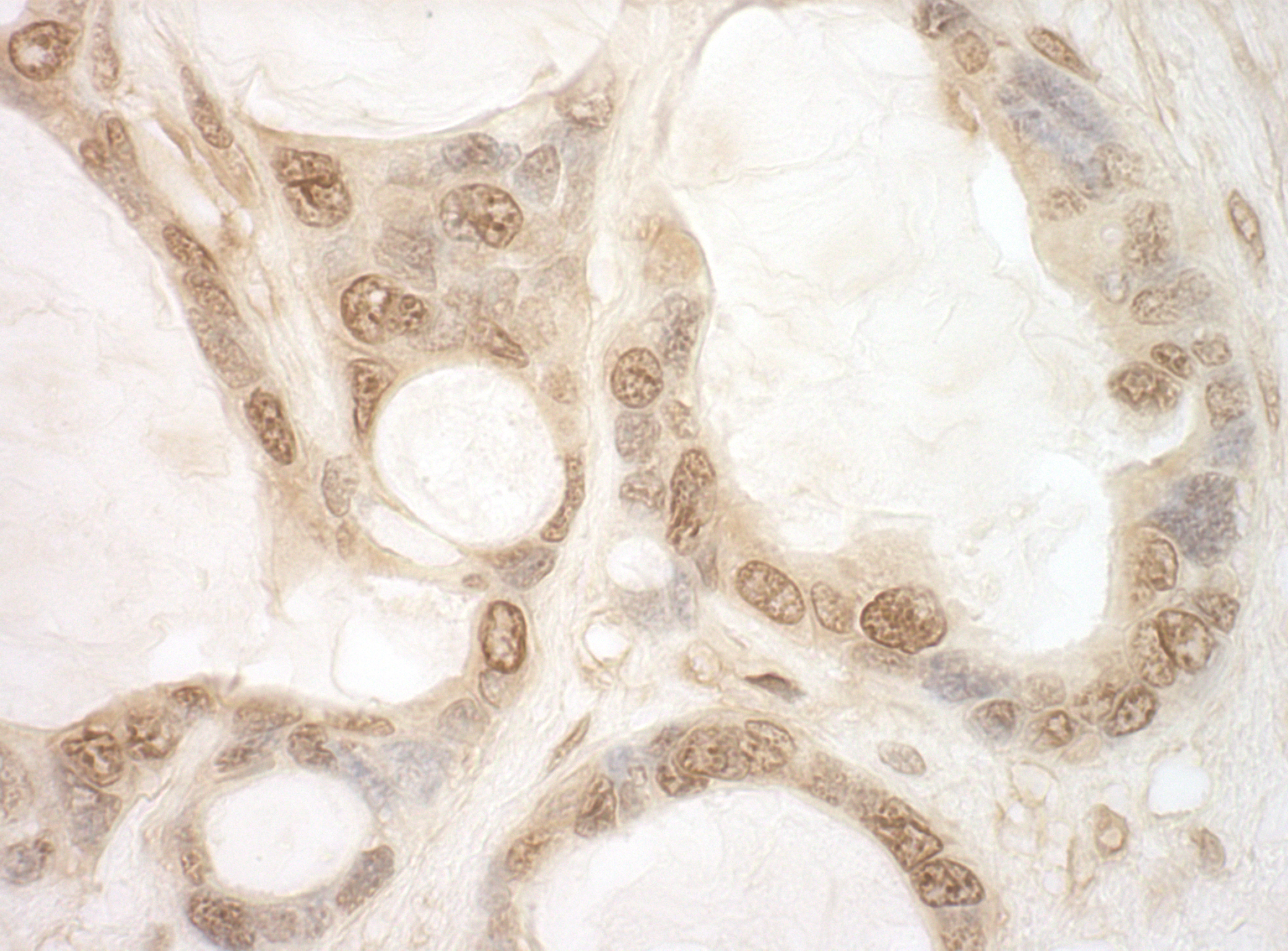 Rabbit anti-eIF2B5 IHC Antibody