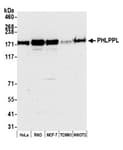 Detection of human PHLPPL by western blot.