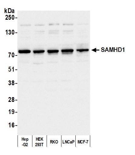 Detection of human SAMHD1 by western blot.