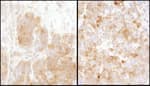 Detection of mouse TS by immunohistochemistry.