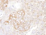 Detection of mouse YB1 by immunohistochemistry.
