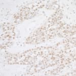 Detection of human ATF1 by immunohistochemistry.