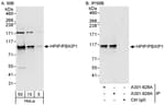 Detection of human HPIP/PBXIP1 by western blot and immunoprecipitation.