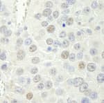 Detection of mouse Rtf1 by immunohistochemistry.