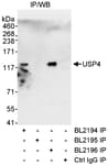 Detection of human USP4 by western blot of immunoprecipitates.