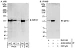 Detection of human and mouse SIPA1 by western blot (h&amp;m) and immunoprecipitation (h).
