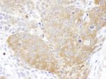 Detection of mouse CCT5 by immunohistochemistry.