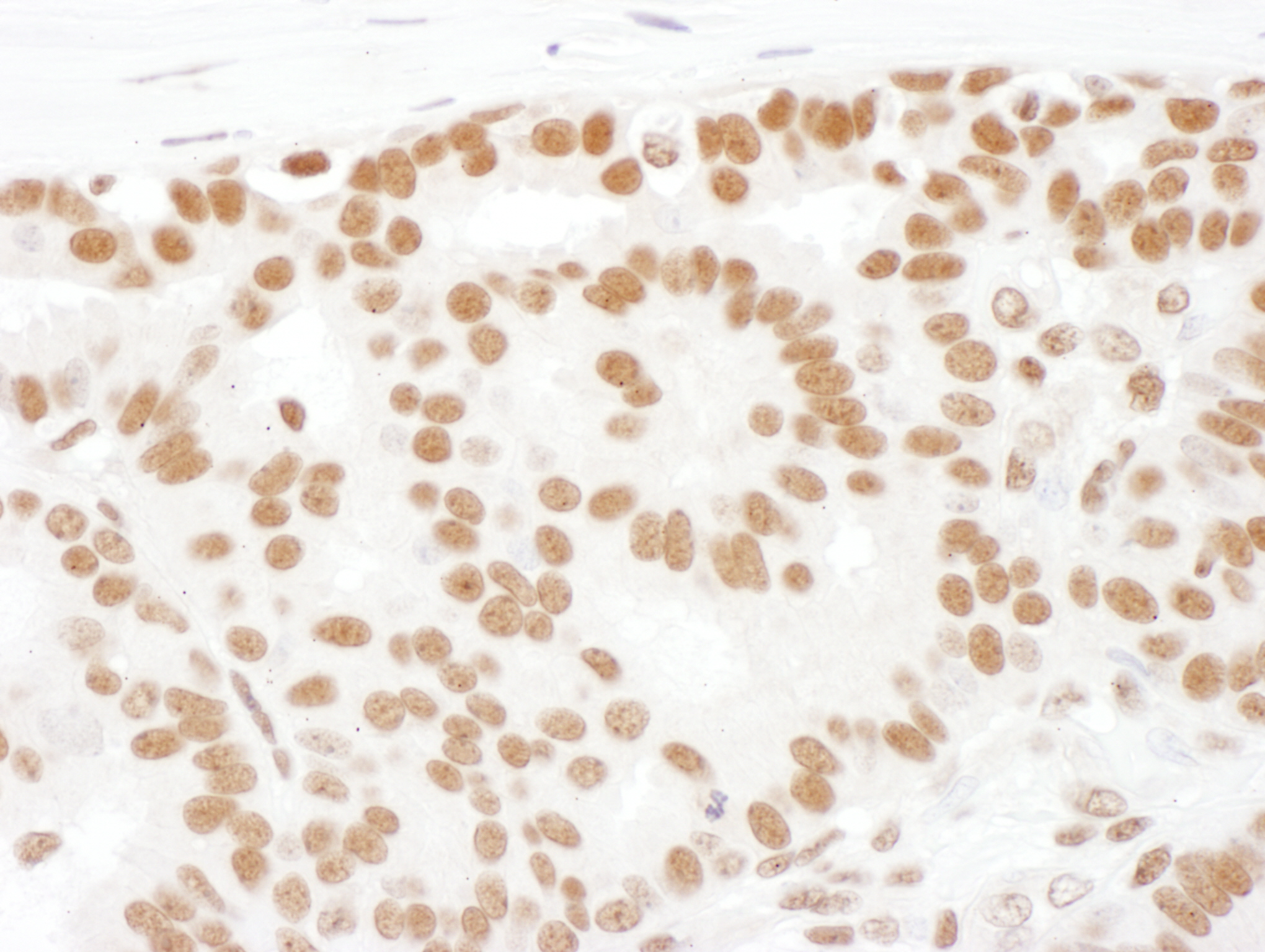 Detection of human SF1 by immunohistochemistry.