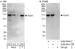 Detection of human PolA1 by western blot and immunoprecipitation.