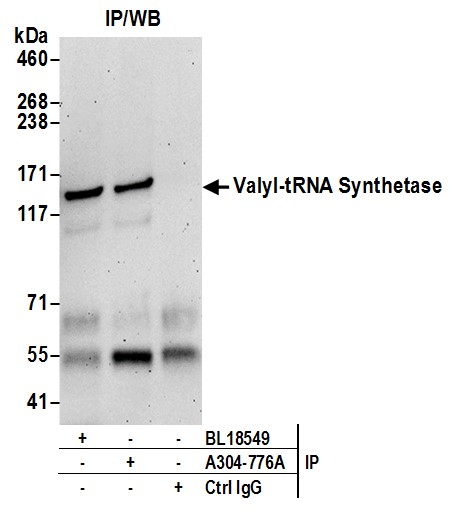 Detection of human Valyl-tRNA Synthetase/VARS by western blot of immunoprecipitates.
