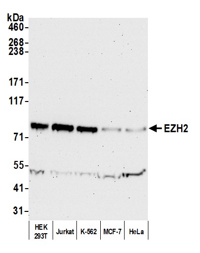 Detection of human EZH2 by western blot.
