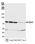 Detection of human EZH2 by western blot.