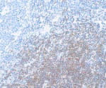 Detection of human CD28 by immunohistochemistry.