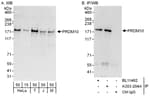Detection of human and mouse PRDM10 by western blot (h and m) and immunoprecipitation (h).