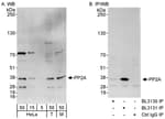 Detection of human and mouse PP2A by western blot (h&amp;m) and immunoprecipitation (h).