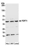 Detection of human FDFT1 by western blot.