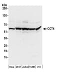 Detection of human and mouse CCT4 by western blot.