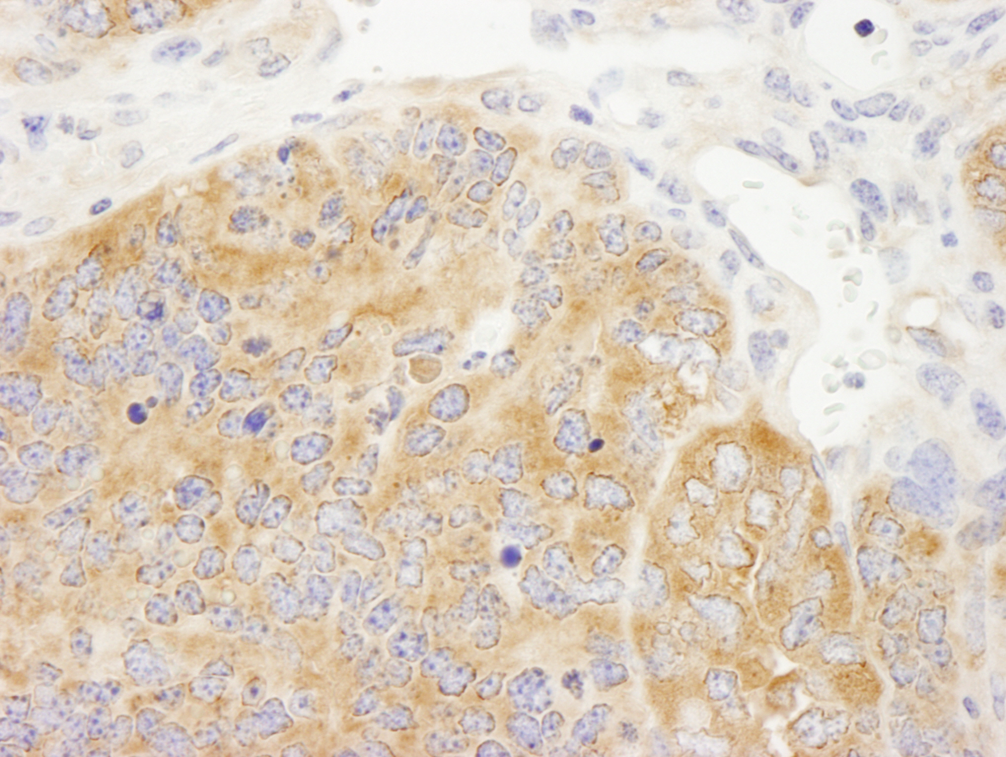 Detection of mouse DDX6 by immunohistochemistry.