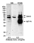 Detection of human SAH3 by western blot and immunoprecipitation.