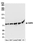 Detection of human and mouse GARS by western blot.
