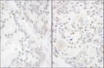 Detection of human and mouse ANKS3 by immunohistochemistry.